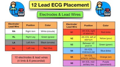 leads for ekg
